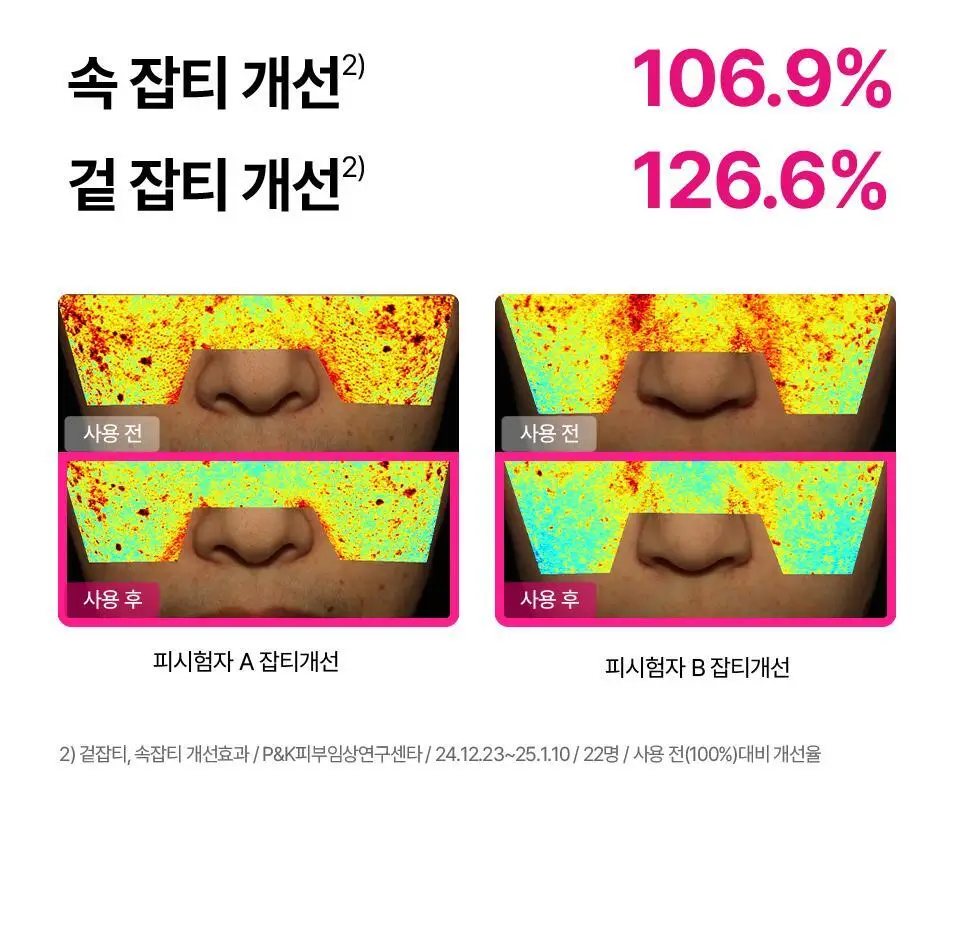 [잡티톤업/키짱PICK] 아이소이 브라이트닝 로즈PDRN 잡티세럼 20ml 기획 (+3ml) 상세페이지 20